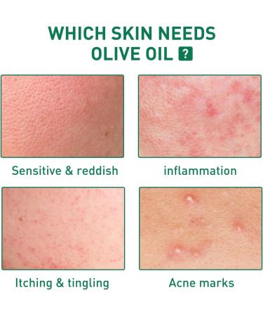 Tea Tree Ance Treatment Serum Tea Tree Oil For Skin Tea Tree Essential Oils Anti-Pimples and Acne Moisturizer and Brighten Skin.Tea Tree Oil for Diffuser Humidifier DIY Home Office 17ml - Buy Online on SooperMarket.com