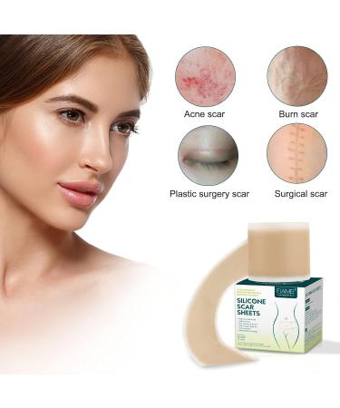 Keloid Bump Removal Silicone Gel Scar Remover Pen - Clear Outdoor Man Skin Care - One Size - Buy Online on SooperMarket.com