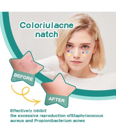 112 Counts Star-Shaped Pimple Patches - Hydrocolloid Acne Stickers for All Skin Types - Effective Pimple Patch Set - Buy Online on SooperMarket.com
