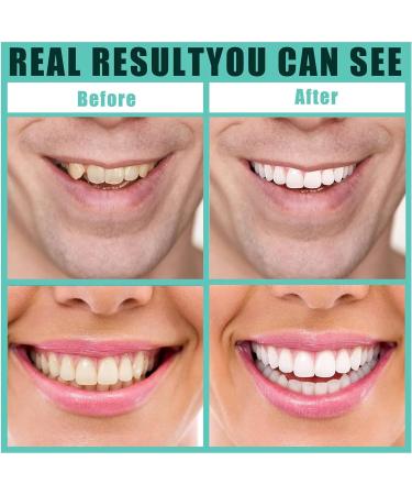 SJENG Smile Bright - 4 Pairs of dentures and 4 Pieces of Tweezers Best Dentures and False Teeth Set with Bonus Tweezers - Enhance Your Smile Today - Buy Online on SooperMarket.com