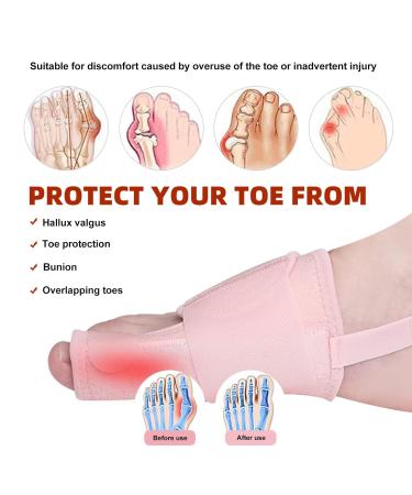 ANGGREK Toe Straightener Hallux Valgus Bunion Corrector for Women - Soft High Elasticity, Relieve Pain, Correct Crooked Toes, Toe Separators Brace - Buy Online on SooperMarket.com