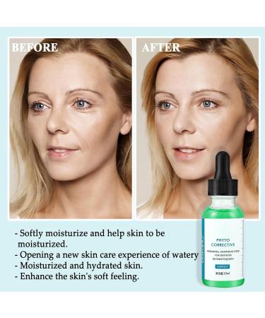 TBeautfave Phytol Corrective Soothing Essence Hydrate & Moisturizing Essence Repair Barrier Improve Dark Circles and Remove Colour Patches Improves Dullness Rejuvenates and Clears Pores 30ml - Buy Online on SooperMarket.com