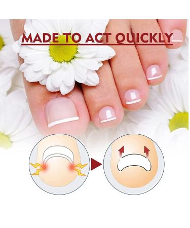 3Pcs German Toenailcare Removal Paronychia Oil for Healthier Toenails - Buy Online on SooperMarket.com