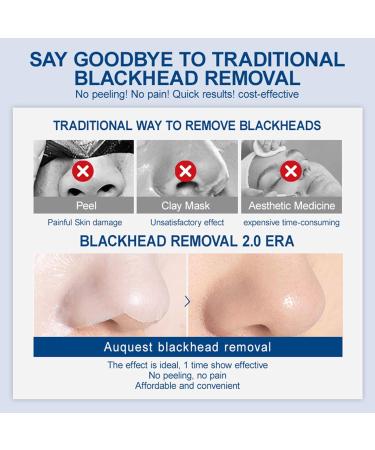 3-Step Blackhead Removal Nose Patch Deep Cleansing Blackhead Remover Nose Strips Newly Upgraded No Peeling No Pain Gentle to The Skin - Buy Online on SooperMarket.com