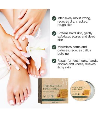 Foot Cream for Cracked Heels and Dry Skin Feet Hard Skin Remover Foot Moisturiser Callus Remover for Feet Nourishes Feet & Hand Foot Care Cream to Improve Elasticity & Smoothen Skin - Buy Online on SooperMarket.com