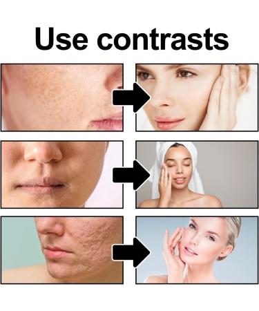 Face Scrub Exfoliating Face Scrub Instantly Reveals Skin Natural Glow Face Exfoliating Gel for Women and Men Removes Blackheads Improves Dark Spots and Acne Smoothes The Skin Natural Formulation - Buy Online on SooperMarket.com