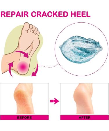 Moisturizing Gel Heel Socks Cracked Gel Heel Socks Toeless Heel Repair Socks for Women (Azure) - Buy Online on SooperMarket.com