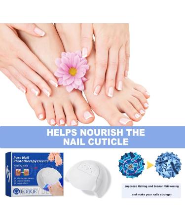 SenhE Fungus Laser Therapy Device Antibacterial Laser Equipment Light Therapy Device Fungal Nail Revolutionary High-Efficiency Light Therapy Device for Toenail Diseases  - Buy Online on SooperMarket.com