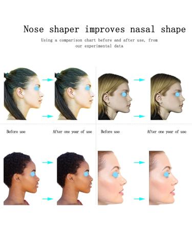 Jieri Nose Shaper Lifter Clip - Nose Slimmer & Reshaper for Men & Women - Effective Nose Straightener Wide Nose Solution - International Shipping Available - Buy Online on SooperMarket.com