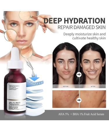 AHA 5% + BH_A 1% Peeling Solution Smooth Skin Exfoliating Facial Serum -Acid Serum For Acne Blackheads & Open Pores Blackhead Remover Reduces Excess Oil & Bumpy Texture 32ml  - Buy Online on SooperMarket.com
