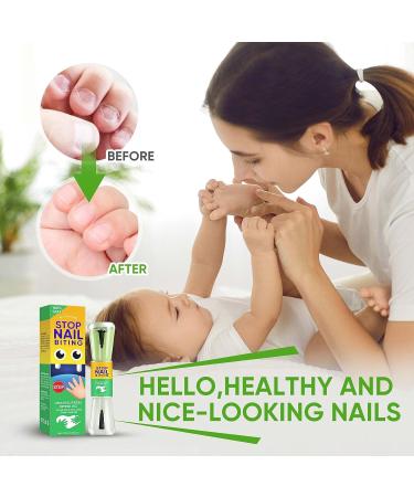 Kids' Nail Biting Treatment | Stop Bad Habits Naturally with Bitter Taste Plant Extract | Safe & Effective - Buy Online on SooperMarket.com