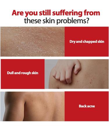 Quick Absorbing Body Cream 100ml Body Lotion Nourishing Moisturizing Skin Brightening Mild Body Cream Skin Brightening Moisturizing Kojic Acid Body Lotion for Dry Skin - Buy Online on SooperMarket.com