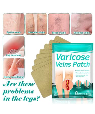Fengyang 16Pcs Varicose Veins Treatment Patch Set for Legs - Spider Vein Relief, Soothes Leg Fatigue - Buy Online on SooperMarket.com