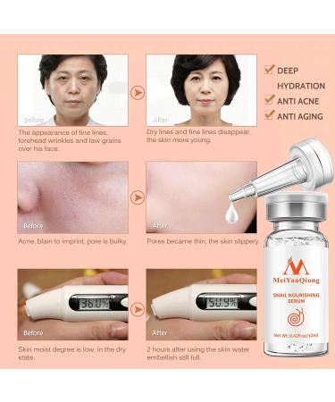 Trendyfave Snail Serum Snail Mucin Serum Nourishing Face Serum for Women Skin Repair Serum Reduce Wrinkles & Dark Spots Hydrating Firm Lift Restore Elasticity Facial Skincare - Buy Online on SooperMarket.com