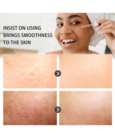 Dark Spot Remover for Face Hyaluronic Acid Dark Spot Correcting Serum Anti Aging Face Serum for Women Nicotinamide Dark Spot Correcting Glow Serum Anti Spot Face Serum and Oil Skin Moisturizer-30ml - Buy Online on SooperMarket.com