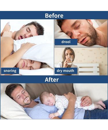 Soft Silicone Tape with Perforation for Improved Nasal Breathing and Snoring Relief (30PCS) - Buy Online on SooperMarket.com