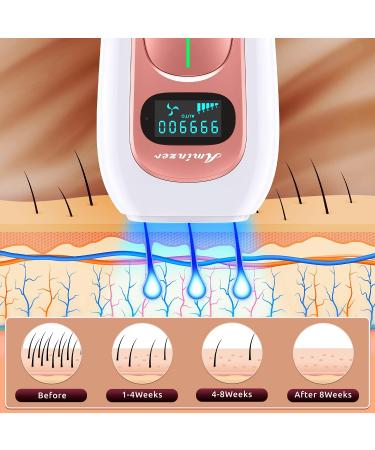 IPL Hair Removal Device for Women and Men - 999,000 Flashes, 5 Energy Levels, 2 Modes, Painless Hair Remover - A-rose Gold - Buy Online on SooperMarket.com