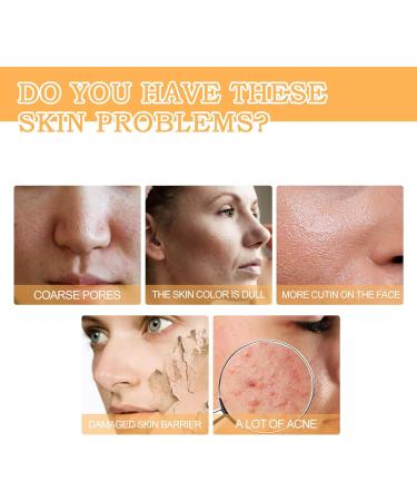Glycolic Acid Toner Glycolic Acid Toning Resurfacing Glycolic Acid Peeling 7% Glycolic Acid Peeling Toner Toning Solution Glycolic Acid 7% Toner Peeling Toner for Body Face Skin with Dark Spots - Buy Online on SooperMarket.com