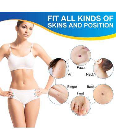 Skin Tag Remover Kit - Painless 2-in-1 Device for Medium to Large Skin Tags (2mm-7mm) - Mole Wart Removal Tool for Women and Men - Buy Online on SooperMarket.com