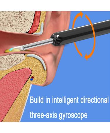 WAITLOVER HD Smart Visual Ear Cleaner - Wax Removal Tool with Mini Camera Otoscope for Ear Cleaning and Earpick Stick Picking - Buy Online on SooperMarket.com