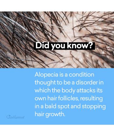 Alopecia Renewal Hair Loss Treatment | Just Nutritive Hair & Scalp Therapy | Nourishing 4 Fl Oz Formula for Soothing Scalp - Buy Online on SooperMarket.com