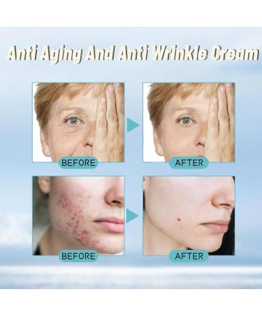 Collagen Retinol Face Cream Face Care Moisturiser For Women Anti-Aging Hyaluronic Acid Face Moisturiser Acne Redness Reducing Face Cream Hydrating Face Cream Face Cream For Mature Skin - Buy Online on SooperMarket.com