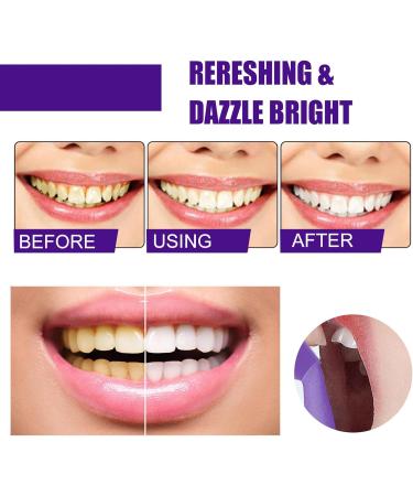 3-Part Whitening Toothpaste Set - Daily Cleaning Spot Removal Fresh Breath & Dental Health (50 ml) - Best International Shipping - Buy Online on SooperMarket.com