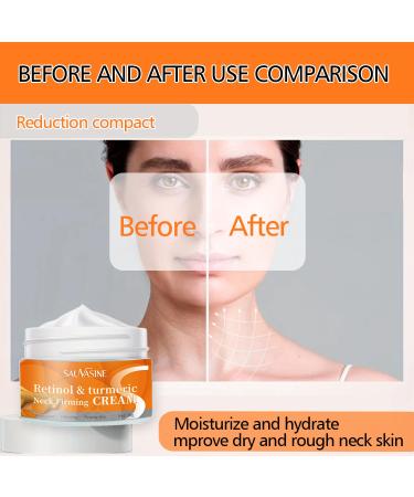 Turmeric Neck Firming Cream - All Natural Skin Tightening & Brightening Lotion for Face & Neck - Buy Online on SooperMarket.com
