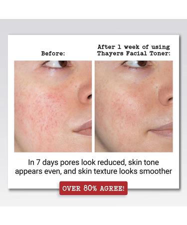 Buy Thayer's Witch Hazel with Aloe Vera - Lavender Toner 12 oz | International Shipping Available - Buy Online on SooperMarket.com
