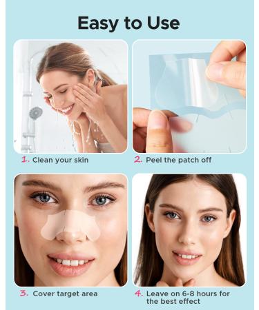 LitBear XL T-Zone Patch - 30 Patches, Hydrocolloid for Nose, Forehead, Chin, Pimple, with Tea Tree & Calendula Oil - Buy Online on SooperMarket.com