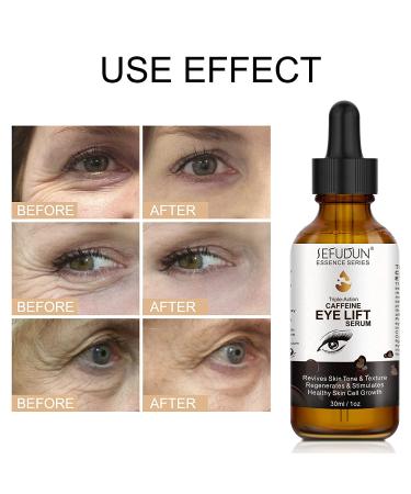 Caffeine Eye Serum for Women | Dark Circles, Puffiness, Eye Bags Treatment | Anti-Aging, Reduces Wrinkles, Fine Lines | 100% Pure Coffee Oil - 1 oz - Buy Online on SooperMarket.com