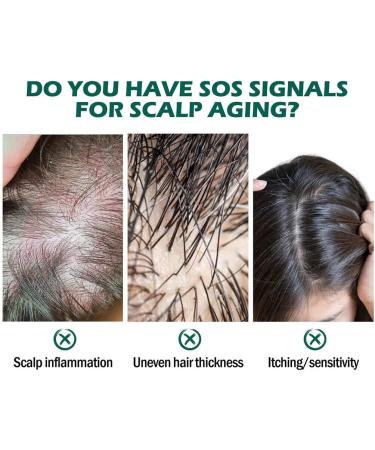 FIOERDTUIE Adults Hair Growth Essential Oil Follicle Repair Moisturizing Nourishing Essence Haircare Serum Beauty Supplies - Buy Online on SooperMarket.com