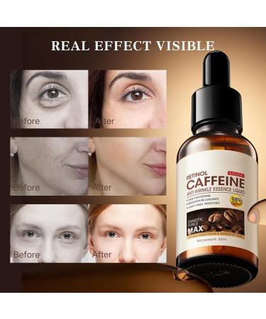 Caffeine Dark Circles Eye Serum Caffeine Serum For Anti Aging Caffeine Face Serum For Reduce Wrinkles Eye Bag Removal Serum Anti Wrinkle Serum Targets Eye Lines & Face Wrinkle 30 ml - Buy Online on SooperMarket.com