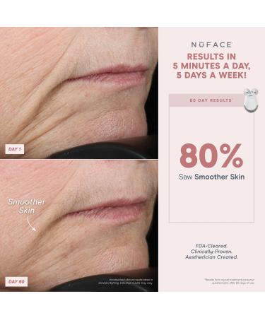 NuFACE Mini & FIX Starter Kits - FDA Cleared Microcurrent Device for Face Sculpting & Line Smoothing - Aqua Gel & FIX Serum Included - Buy Online on SooperMarket.com