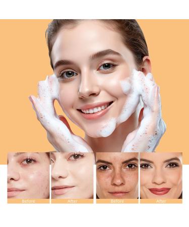 Shop Turmeric Face Wash - Acne Cleanser Kojic Acid Foaming Facial Cleanser for Women | 5.28 FLOZ - Buy Online on SooperMarket.com