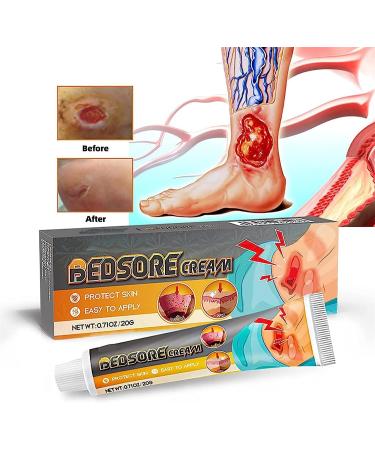 KXC Decubitus Treatment Cream 20g - Relief for Pressure Sores (4 pcs) - Buy Online on SooperMarket.com