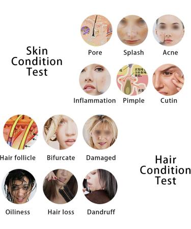 Asixxsix Skin Diagnosis Hair Analyzer | 5 Inch LCD Digital Tester for Hair & Skin | Rechargeable Follicle & Oil Magnifying Device - Buy Online on SooperMarket.com