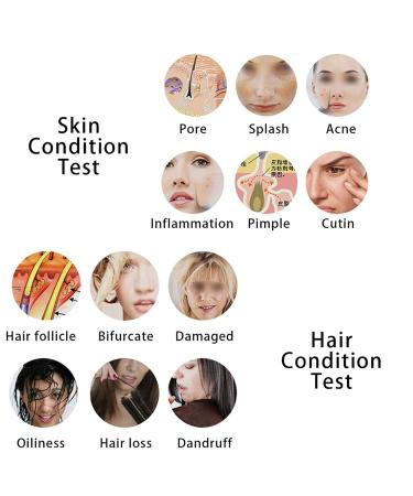 5-Inch Skin & Hair Analyzer | Hair Scalp Detector with Magnifying Glasses | Rechargeable & Intuitive Skin Detection - Shop Now - Buy Online on SooperMarket.com