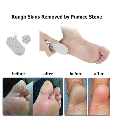 Moisturizing Gel Socks for Dry Cracked Feet | KVMDAZ Soft Spa Socks - International Shipping Available - Buy Online on SooperMarket.com
