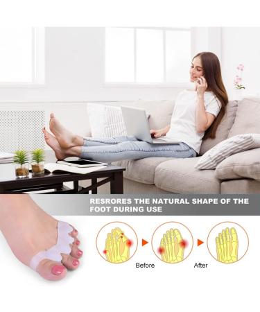 2 Pair Gel Toe Separators - Bunion Corrector for Women & Men - Toe Spacer & Straightener - White - Buy Online on SooperMarket.com