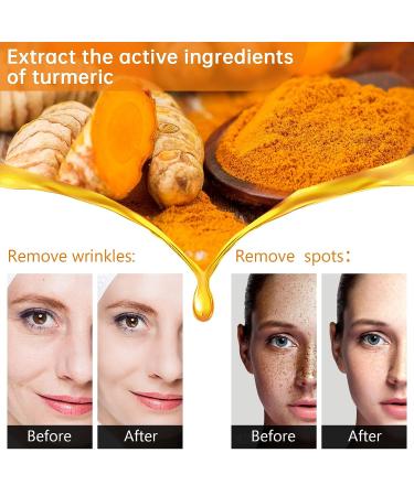 Turmeric Dark Spot Corrector Serum for Women - Anti-Aging Face Serum with Curcuma Longa - Even Skin Tone, Remove Dark Spots & Age Spots - Daily Skin Care Solution - Buy Online on SooperMarket.com