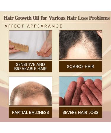 Trendyfave Hair Growth Serum Hair Serum for Hair Growth Ginger Hair Growth Serum Anti Hair Loss Essence for Fast Hair Growth Nourishing Repair Damaged Hair Stimulates Hair Growth Serum for Women Men - Buy Online on SooperMarket.com