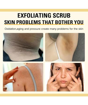 Turmeric Body Scrub Turmeric Scrub with Vitamin C Natural Face Exfoliator Scrub Exfoliating Body Scrub With Turmeric Turmeric Body Scrub For Neck Armpit Back Skin Care Scrub 150G/5.29OZ - Buy Online on SooperMarket.com