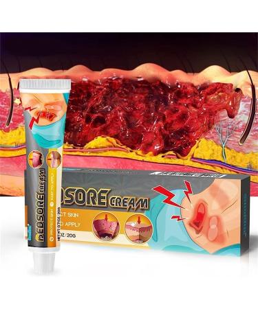 KXC Decubitus Treatment Cream 20g - Relief for Pressure Sores (4 pcs) - Buy Online on SooperMarket.com