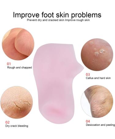 Moisturizing Socks for Soft Skin | ANGGREK Exfoliating Anti-Cracking Pedicure Socks (XL 42-44) - International Shipping Available - Buy Online on SooperMarket.com