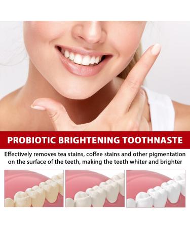SP-6 Probiotic Whitening Toothpaste - Ultra Whitening & Deep Cleaning - Brighten Your Smile - Buy Online on SooperMarket.com