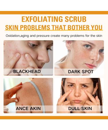 Orange Face Exfoliator Vitamin C Face Scrub Mild Exfoliating Face Wash Orange Exfoliating Gel For Brightening Skin Exfoliating Scrub Remove Dead Skin For Smooth & Radiant - Face & Body &Knee - Buy Online on SooperMarket.com