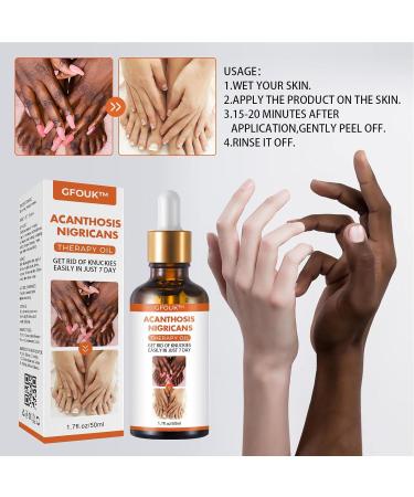 Skin Bleaching Serums | Dark Skin Permanent Whitening Lightening | Armpit Bleaching Serums for Women Supercharged Face Serums Skin Lightening Bleaching Oil Black Spot Corrector Remover for Face 2Pcs - Buy Online on SooperMarket.com
