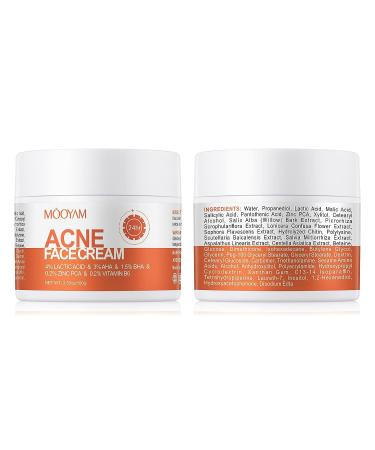 Salicylic Acid Acne Treatment Cream for Face & Body - Teens & Adults | Anti-Acne Moisturizer & Spot Treatment - Buy Online on SooperMarket.com