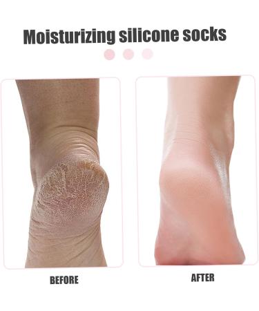 Silicone Moisturizing Socks 1 Pair Long Soft Gel Socks Anti Slip Women Foot Mask Socks Spa Pedicure for Dry Cracked Feet Softening Calluses Rough Skin L - Buy Online on SooperMarket.com